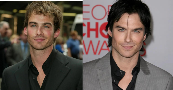 Ian Somerhalder Before And After Surgery